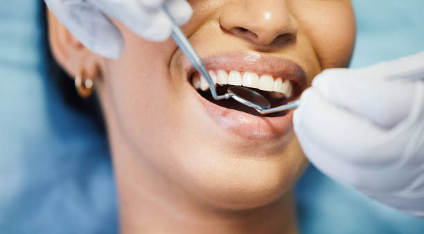 Best Teeth Whitening  in Rio Grande, OH